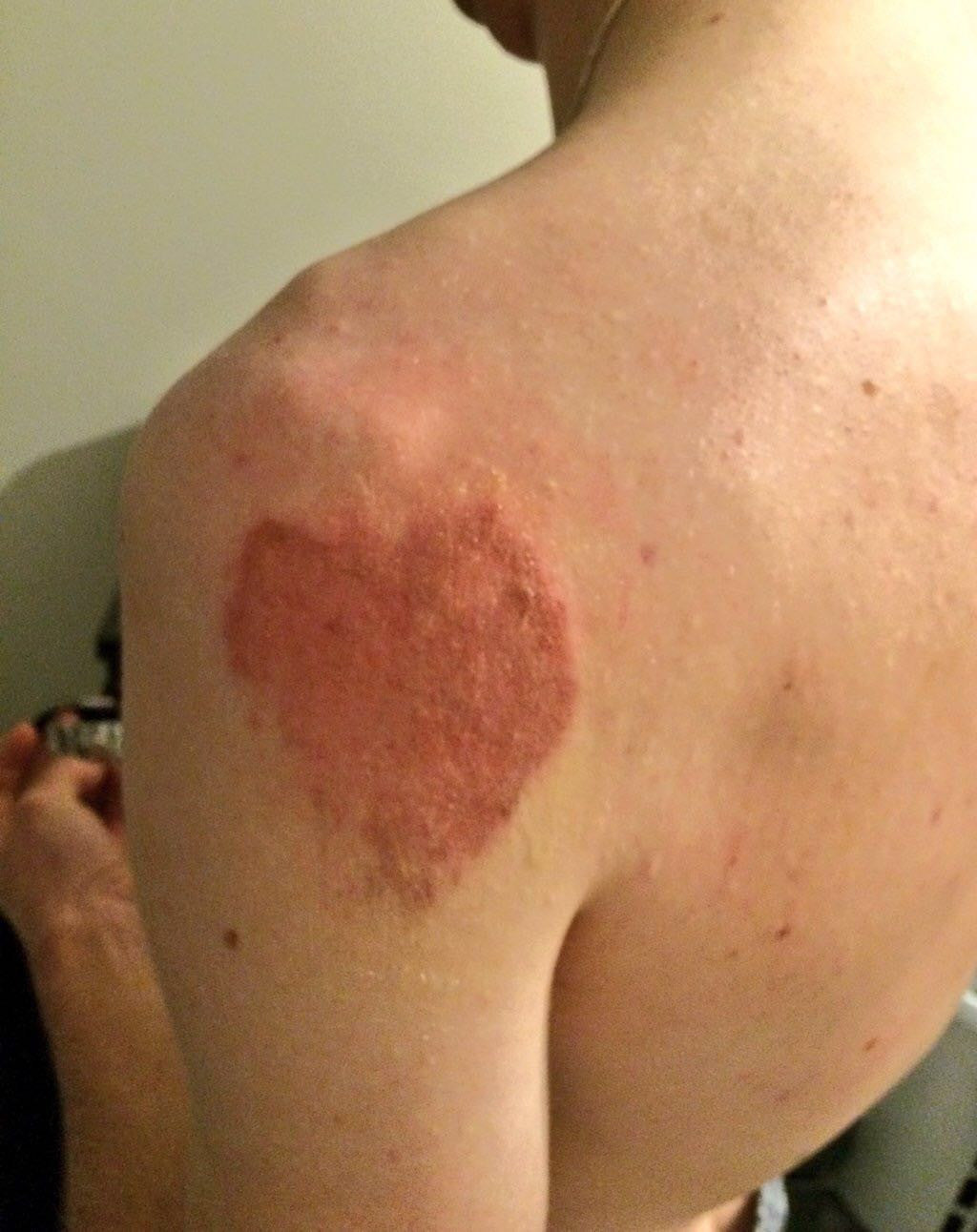Liverpool's Leeuwenhart: Hard breaks & heart-shaped aches